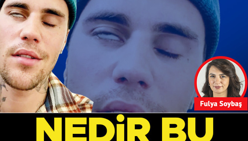 Nedir bu Ramsay Hunt sendromu
