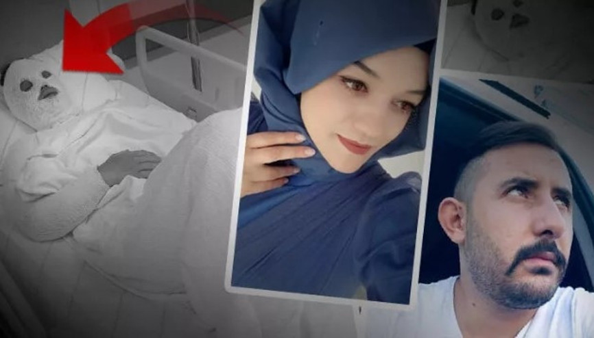 Su sayacına bakacağız diyerek açtırdığı kapıdan eski nişanlısının yüzüne yanıcı madde attı
