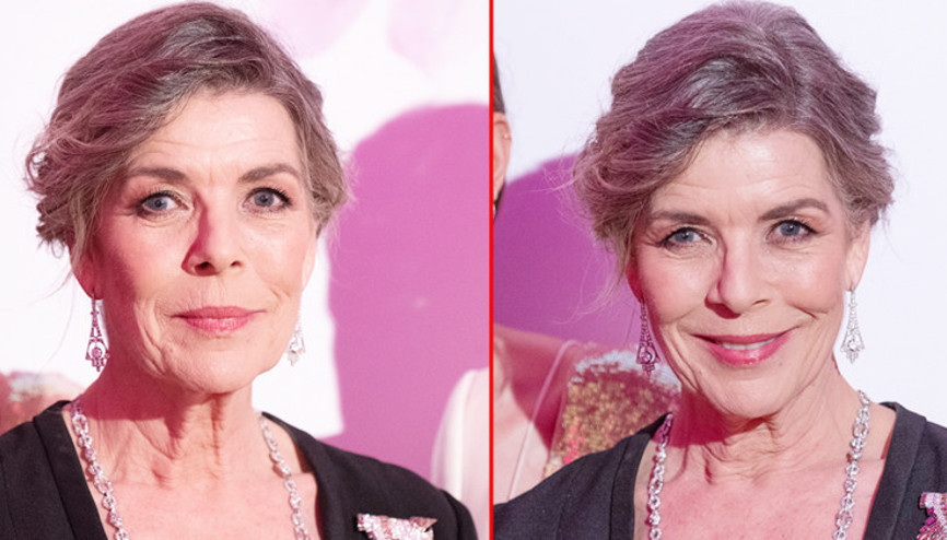 Bir zamanlar güzelliğin simgesiydi: Estetikle arası yok