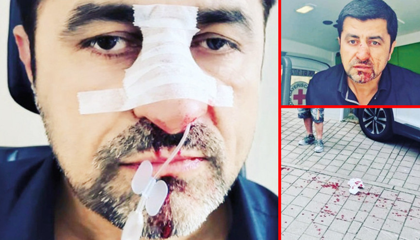 SPD vekili Taşdelen’in abisine ırkçı saldırı