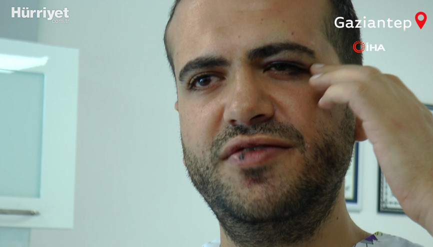 Gaziantep’te hekimden hekime şiddet kamerada Gaziantep’te hekimden hekime şiddet kamerada