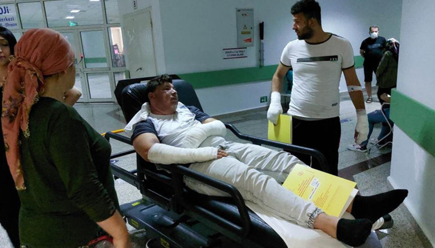 Orduda çakmak bomba gibi patladı: 2 yaralı