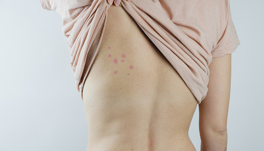 Dünyanın en ölümcül canlısı Sivrisineklerin sırrını bilim insanları çözdü