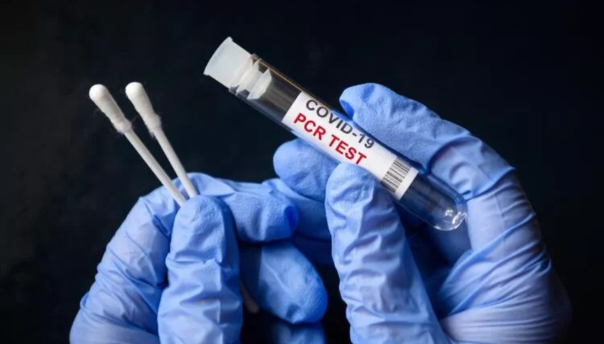 Covid test sonucu ne zaman çıkar İşte Kovid 19 test sonuçları hakkında bilgi