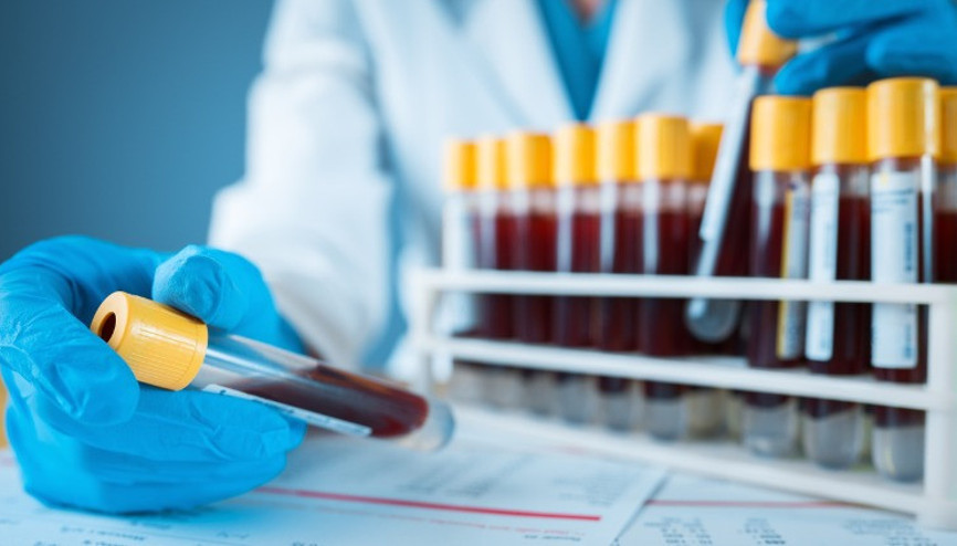 E-Nabız barkod no nedir, nereden alınır E-Nabız barkod no ile tahlil sonucu öğrenme E-Nabız barkod no nedir, nereden alınır E-Nabız barkod no ile tahlil sonucu öğrenme