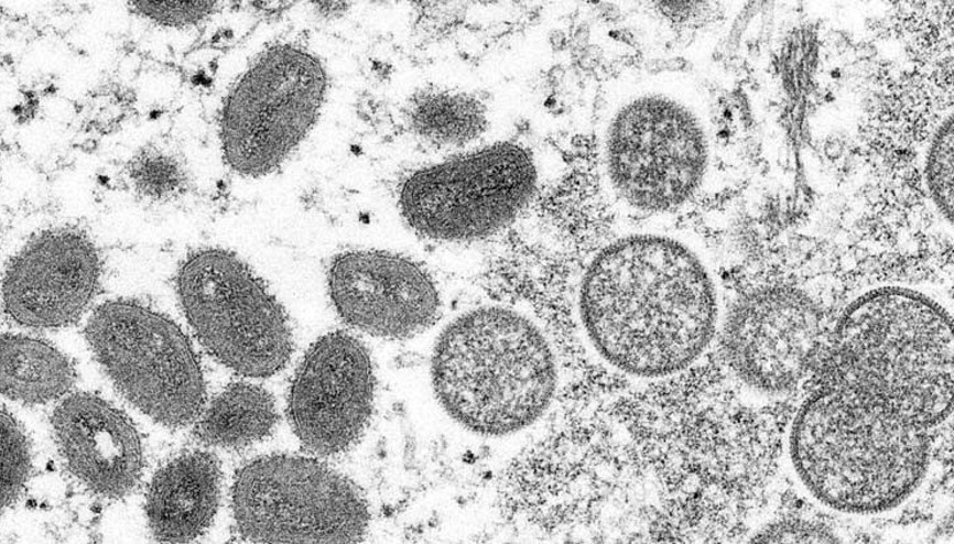 Sağlık Bakanlığı’ndan Maymun çiçeği rehberi