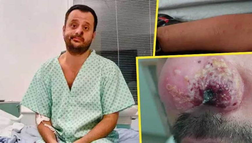 3 virüsü de yendi, damgalanmayı yenemedi