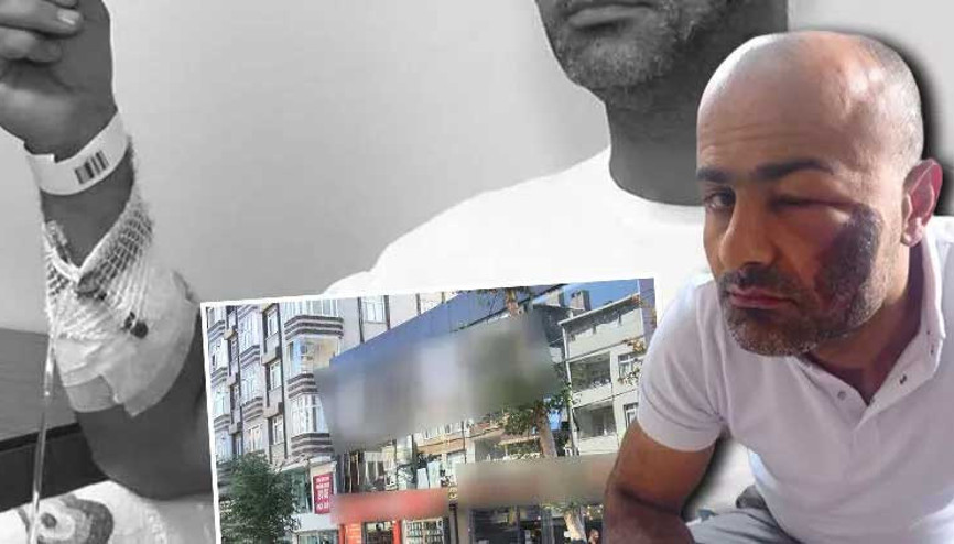 Lazer epilasyon yaptırmak istedi hayatı kâbusa döndü Lazer epilasyon yaptırmak istedi hayatı kâbusa döndü