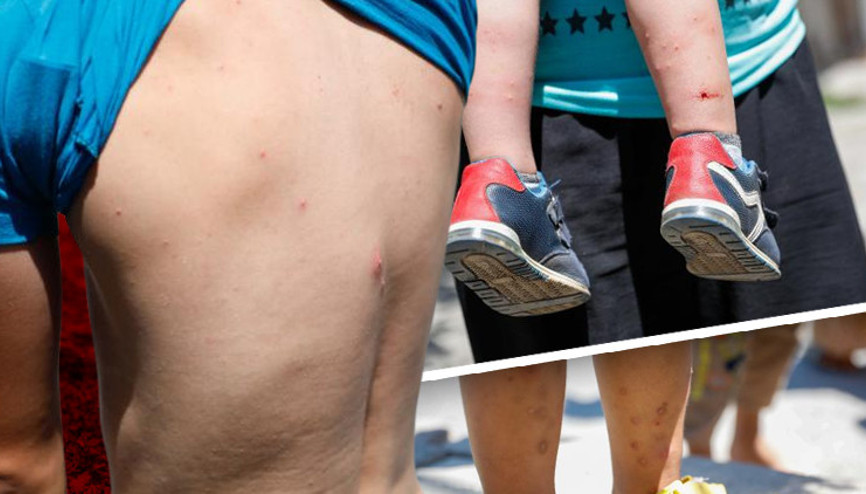 İstanbulda Aedes sivrisineği tehdidi Sayıları giderek artıyor... Uzman isimden önemli uyarı