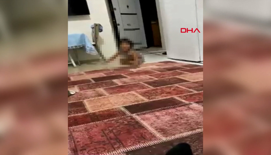 Pitbull saldırısında yaralanan Asiyenin görüntüleri tepki çekti