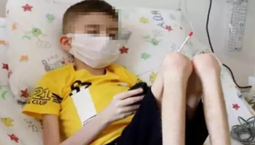 Çöp evde bulunan Cem Muhammet, 20 kiloya ulaştı