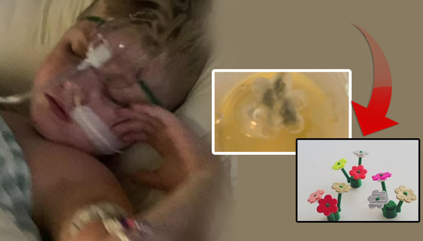 Doktorlar astım teşhisi koydu Boğazına sıkışan oyuncak yüzünden 5 yıl öksürmüş...