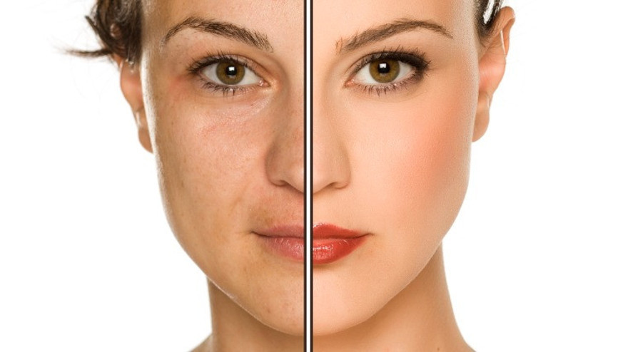 BİR SORUDAN FAZLASI | Fotoğrafın filtreli mi