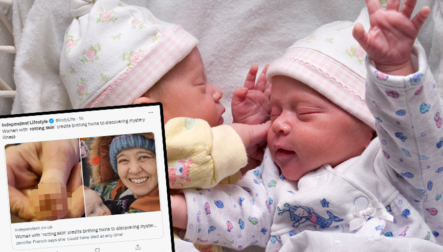 Her an ölebilirdi... Gizemli hastalığını ikiz bebekleri sayesinde öğrendi