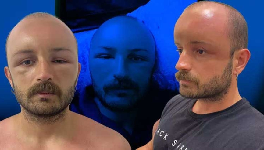 2 gün plaja gitti soluğu korku ile hastanede aldı