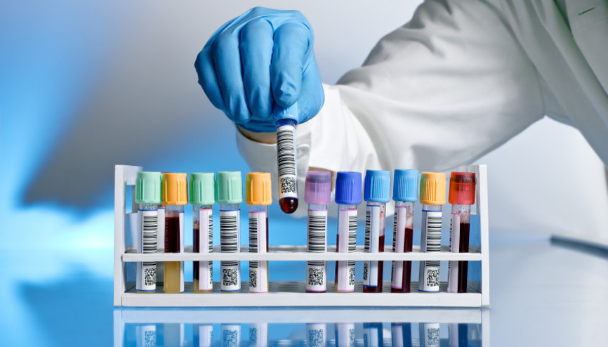 Salmonella nedir Salmonella bakterisi ne demek ve belirtileri nelerdir Salmonella nedir Salmonella bakterisi ne demek ve belirtileri nelerdir