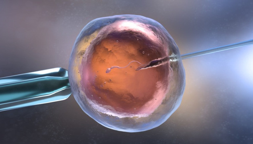 Spermin kuyruklu ya da kuyruksuz olması ne ifade eder Spermin kuyruklu ya da kuyruksuz olması ne ifade eder