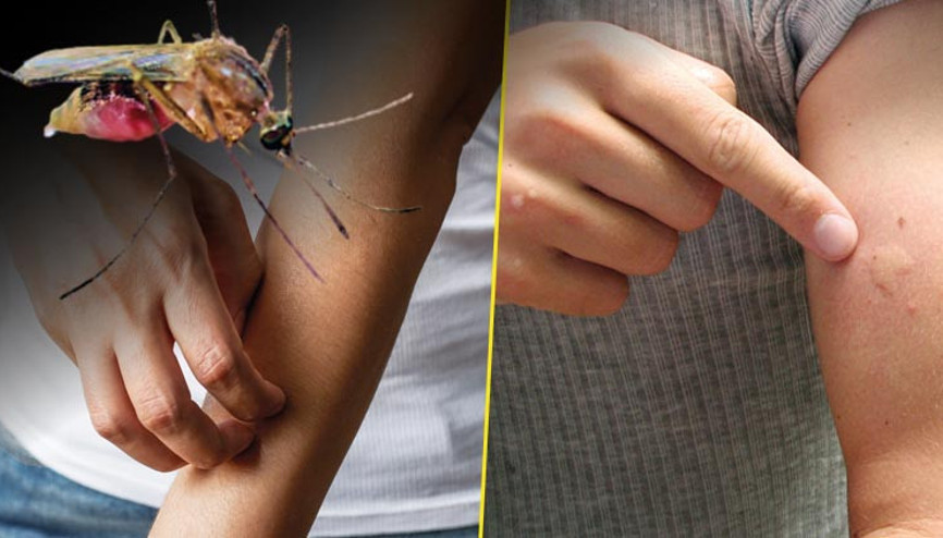 Yunanistan alarm verdi... Türkiye için sivrisinek uyarısı geldi