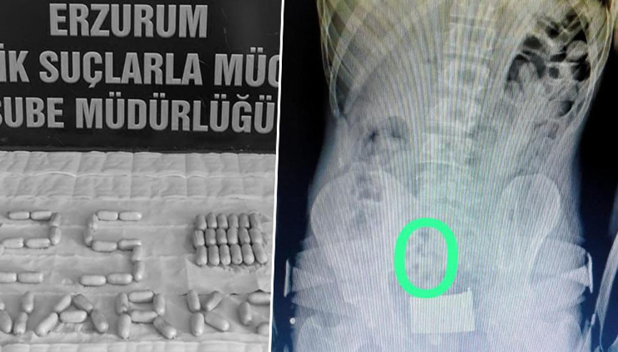 Polis şüphe üzerine durdurdu, midesinden eroin çıktı