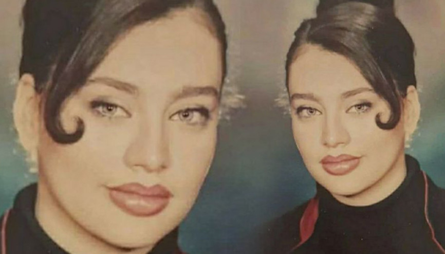 Ünlü şarkıcı 17 yaşındaki fotoğrafını paylaştı... Dudakları estetik değilmiş