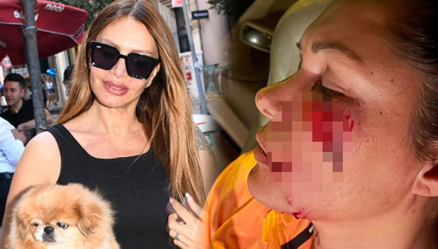 Sevda Demirelden şaşırtan iddia: Tuğba Altıntopa köpek saldırmamıştır...