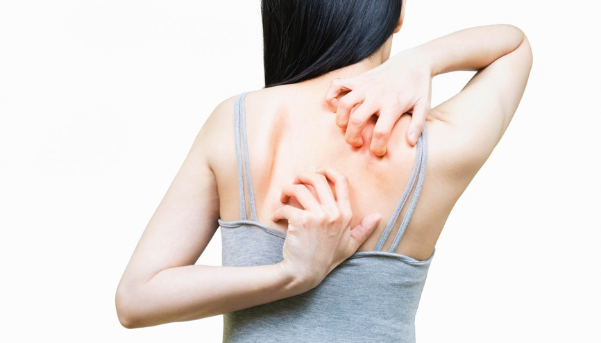 Bakanlıktan sivri rehberi: Sineklik, cibinlik, uzun kol