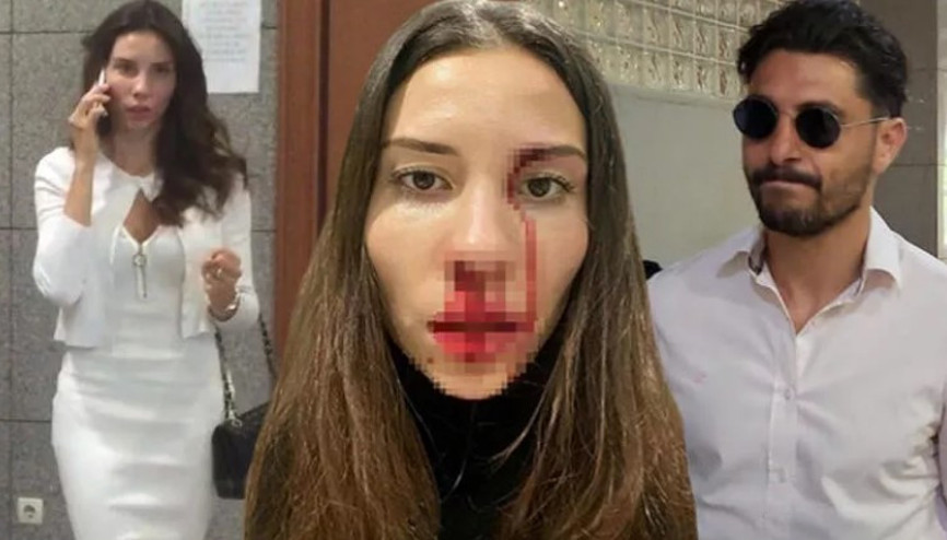 Mihriban Hurmacı ile Özer Hurmacının darp davasında karar