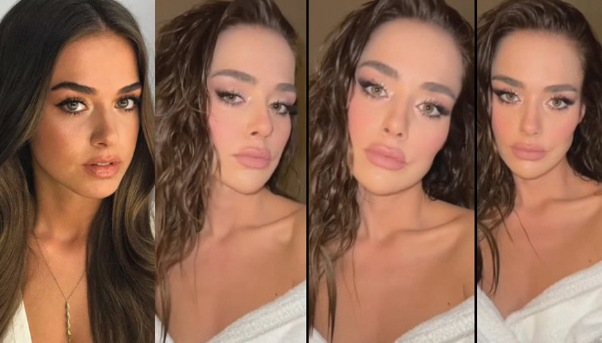 O da estetik modasına uydu... Bensu Soralın son hali çok konuşuldu