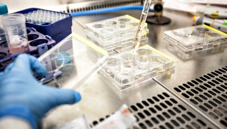 Günlük alışkanlıklarınız sperm şeklini bozabilir