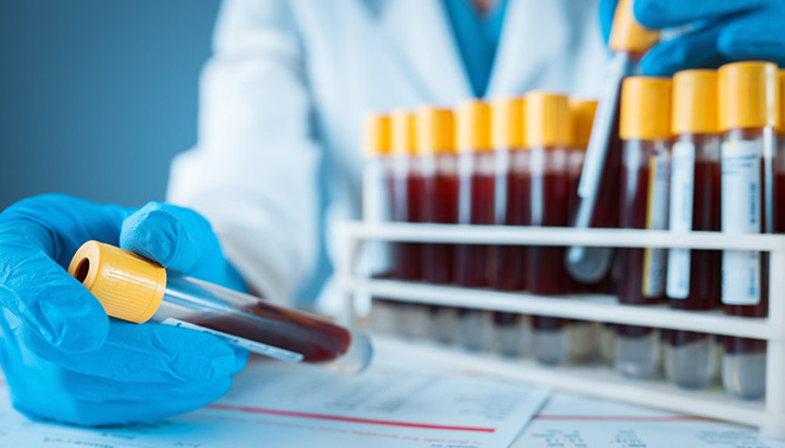 İngilterede kan alarmı: Acil olmayan operasyonlar iptal edilebilir