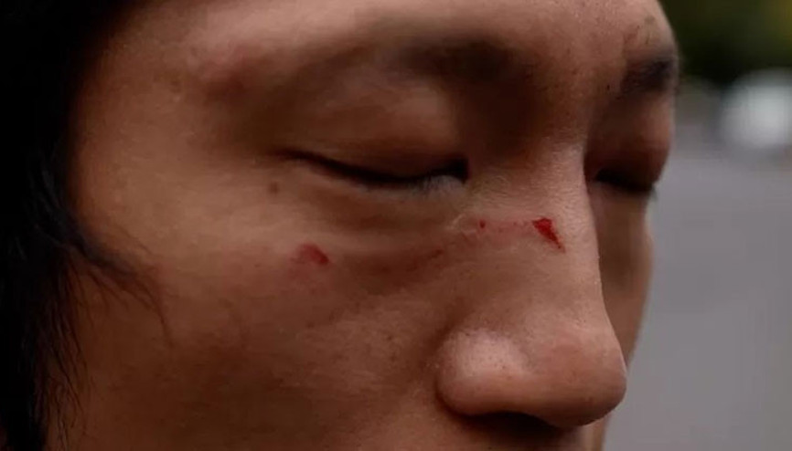 Hong Konglu protestocuya M﻿anchesterdaki Çin Konsolosluğunda dayak