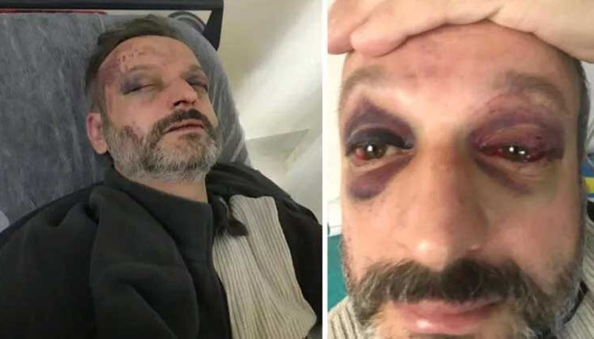 Bursada istek şarkı dehşeti
