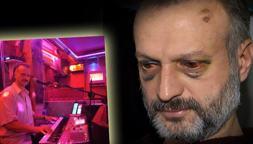 ‘Çiftetelli’ çalmadığı için dövülen Özkan Süslerer kâbus dolu dakikaları anlattı