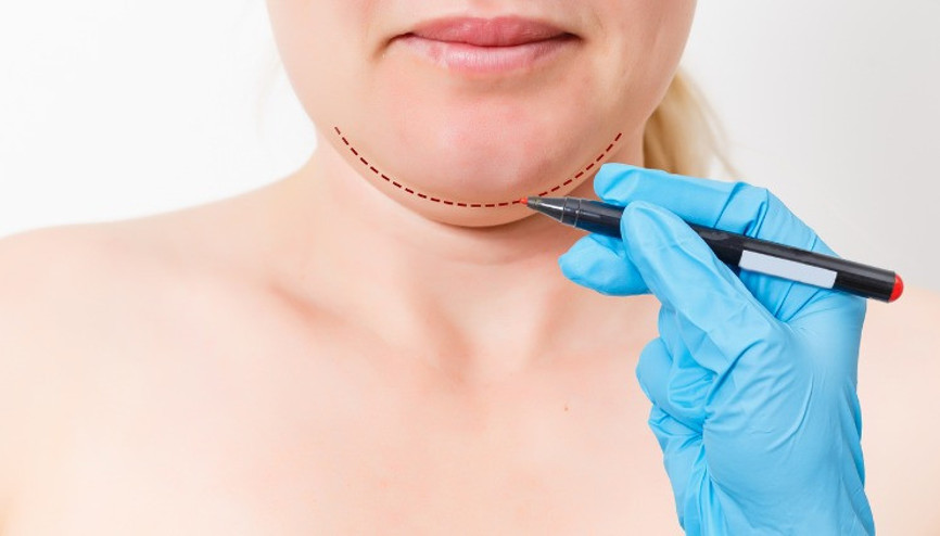 Yüz egzersizleri gıdı sarkması problemlerine iyi gelir mi