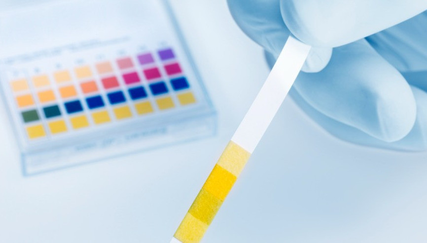 İdrar deyip geçmeyin birçok hastalığın habercisi olabilir... Hangi renk tehlikeli