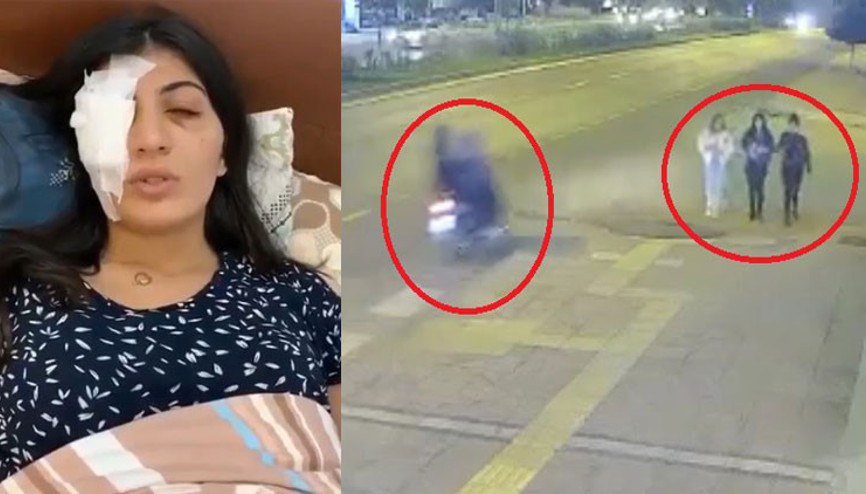 Motosikletten atılan cisim gözüne isabet etti, Hatice Aslanın korneası zarar gördü