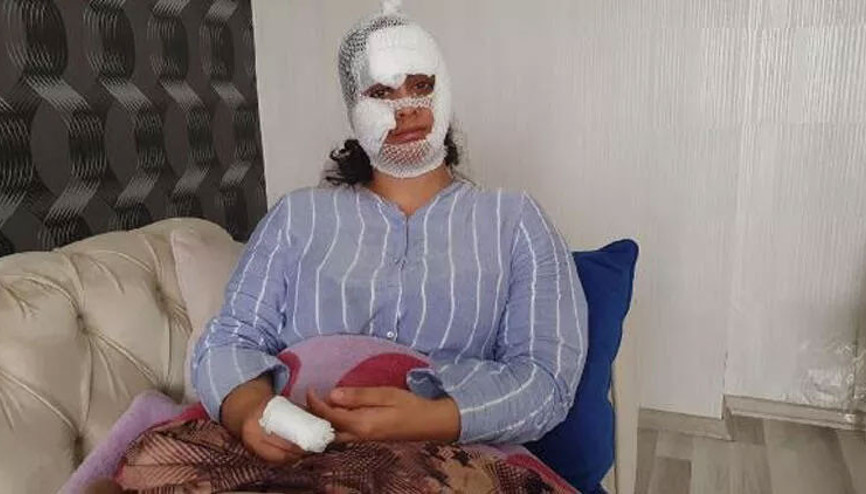 Eşinin bıçakladığı Gülcan: Ölen kadınlardan olmak istemiyorum Eşinin bıçakladığı Gülcan: Ölen kadınlardan olmak istemiyorum