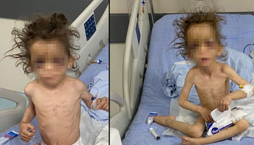 Kan donduran olay 5 yaşındaki çocuk günlerce aç bırakılmış, işkenceci anne tutuklandı