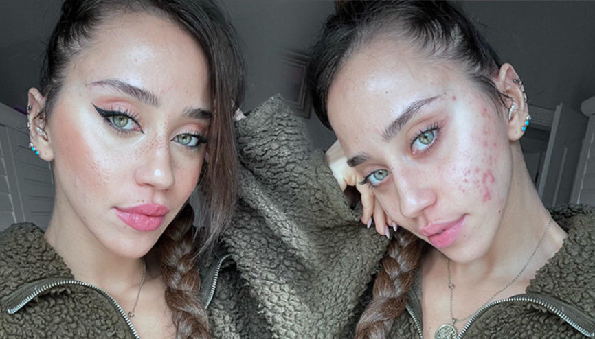 Özgüvenim sıfır demişti... Makyajsız fotoğraf geldi