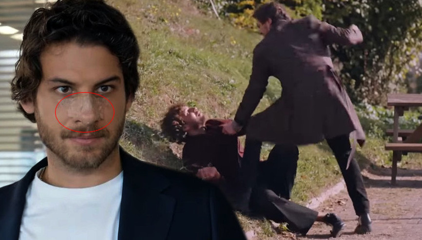 O sahne gerçekmiş.. Taro burnumu kırdı