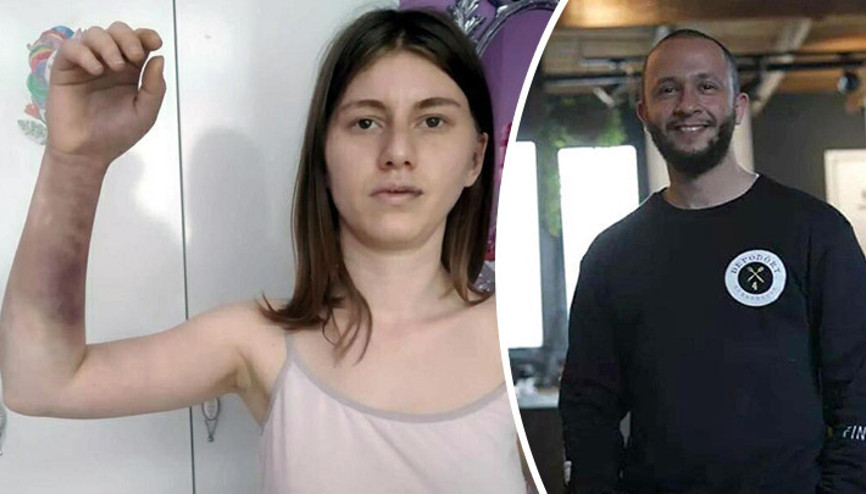 Kız arkadaşını beyzbol sopasıyla döven sanığa, şantajdan ertelemesiz 10 ay hapis Kız arkadaşını beyzbol sopasıyla döven sanığa, şantajdan ertelemesiz 10 ay hapis