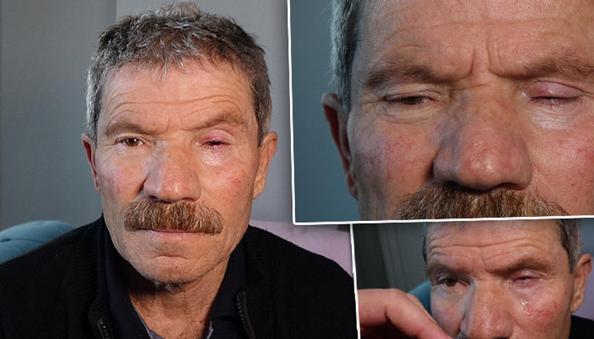 Trabzonda katarakt ameliyatı kör etti iddiası: Adli ve idari soruşturma başlatıldı