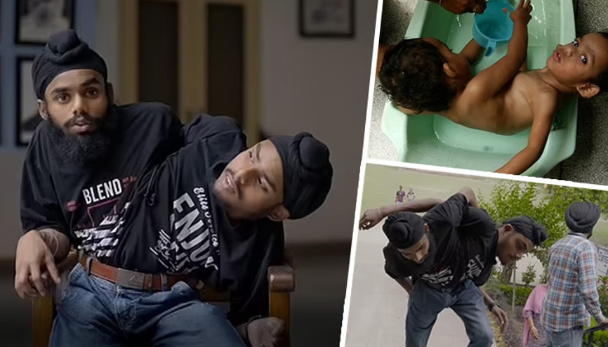 Türk Youtuberın videosu ortalığı karıştırdı İngiltere ve Hindistanın konuştuğu yapışık ikizler...