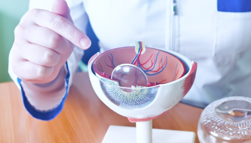 Katarakt nedir, neden olur