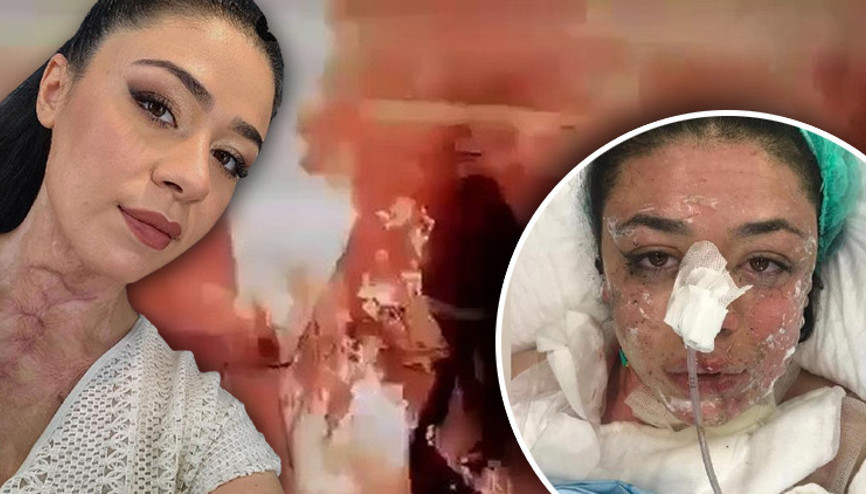Gizem hemşire acil serviste dehşeti yaşadı Çakmak çakıp Yakayım mı sizi diye sormuş: Kendini böyle savundu Gizem hemşire acil serviste dehşeti yaşadı Çakmak çakıp Yakayım mı sizi diye sormuş: Kendini böyle savundu