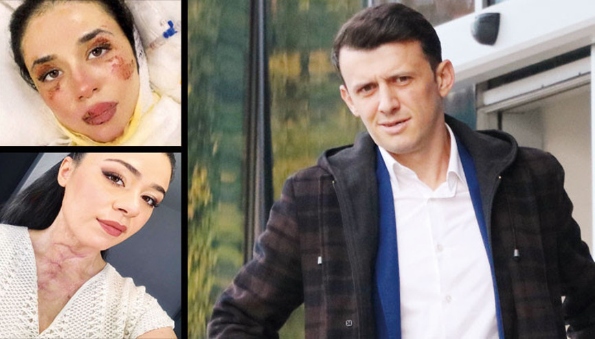 Hastanede şişelere alkol dolduran iş arkadaşlarını yakan hemşireden akıl almaz savunma Hastanede şişelere alkol dolduran iş arkadaşlarını yakan hemşireden akıl almaz savunma