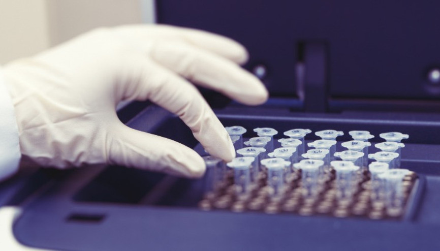 Son yıllarda sperm sayısındaki düşüş endişe yaratıyor