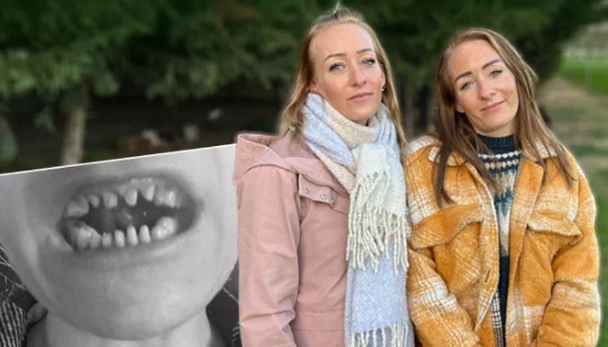 Diş tedavisi için İstanbula gelen Danimarkalı ikizlere sahte klinik şoku