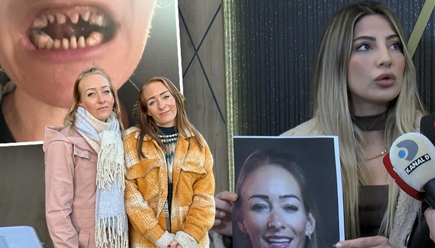 Danimarkalı ikizler İstanbulda kâbusu yaşadı Dişlerini kaybettiler... O klinik için harekete geçildi