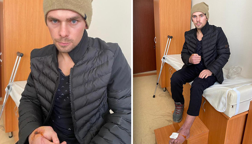 Kopan el parmağı yerine ayak parmağı dikildi